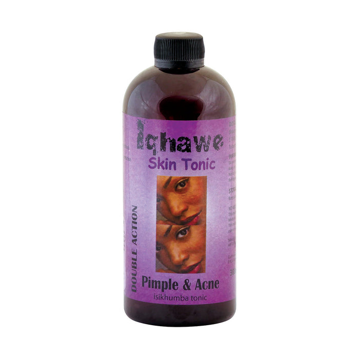 Iqhawe Skin Tonic Pimple & Acne 300ml